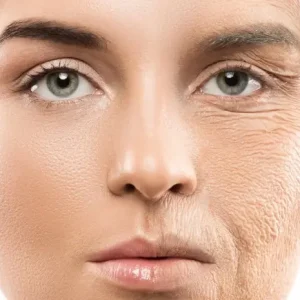 Guide to Preventing Wrinkles at a Young Age