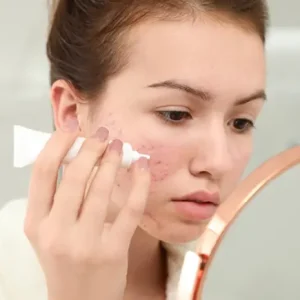 How to Treat Sensitive Skin Safely